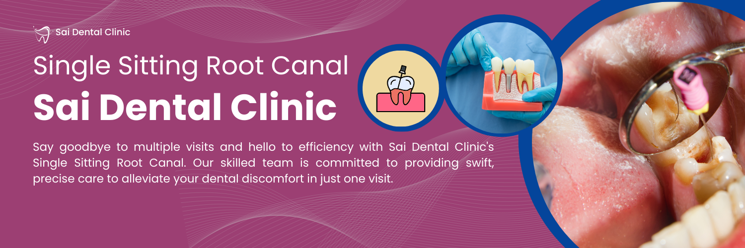 Single Sitting Root Canal in Pimpri Chinchwad Dr Lokhande Dental Clinic