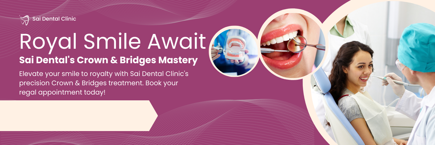Crowns & Bridges Treatment in Pimpri Chinchwad Dr Lokhande Dental Clinic